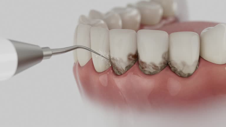Trusted Dental Crowns And Bridges service in Homestead Meadows South, TX - Dentist Open Now